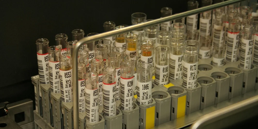 Lab rack of numbered water testing tubes/vials used for turtle tank water quality testing.